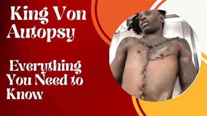 The Disturbing Autopsy Of King Von: A Tragic End