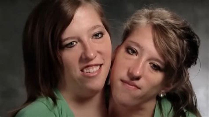 Tragic Loss: The Death Of Conjoined Twins Abby And Brittany Hensel