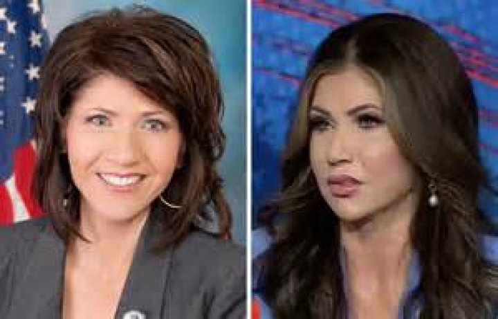 Transformative Journey: Kristi Noem Before And After Pics
