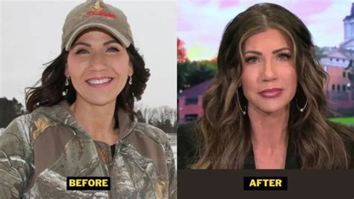 Transformative Journey: Kristy Noem Before And After